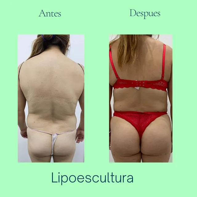 Clínica Malai antes y despues