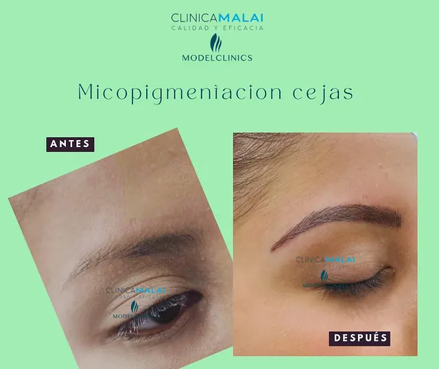 Clínica Malai antes y despues